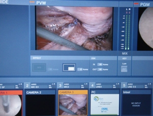 Mixing endoscopic and other video images from 3 operating theatres Mixing endoscopic and other video images from 3 operating theatres in Leuven